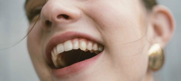 dents