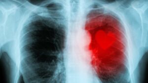 Cœur rouge sur une radiographie