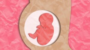 Femme enceinte