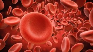 thrombose veineuse