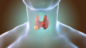 Thyroïde