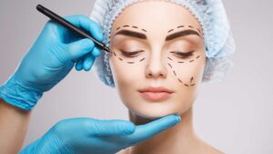 chirurgie esthétique
