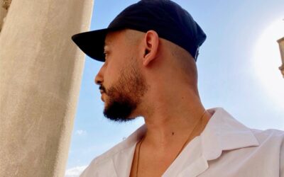 Quels sont les vrais résultats d’une greffe de cheveux FUE ?