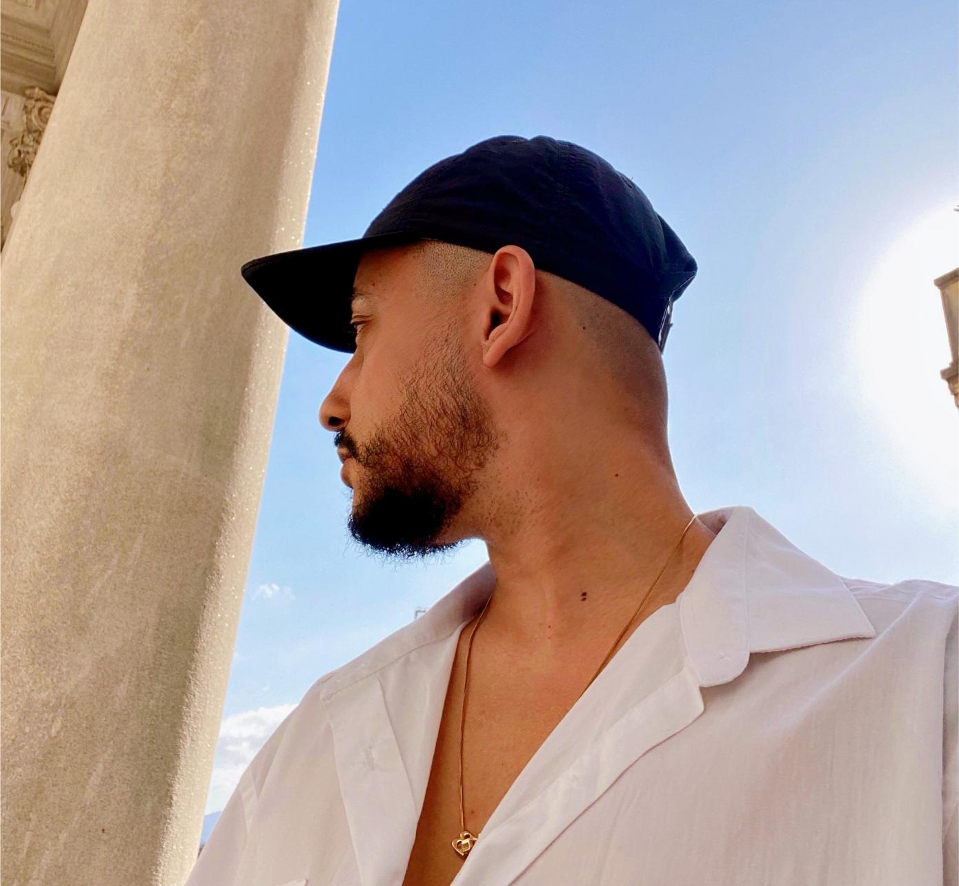 greffe capillaire homme